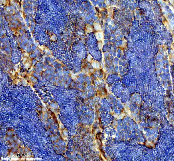 azb3dkp1 flt1 primary antibodies ihc testing 6