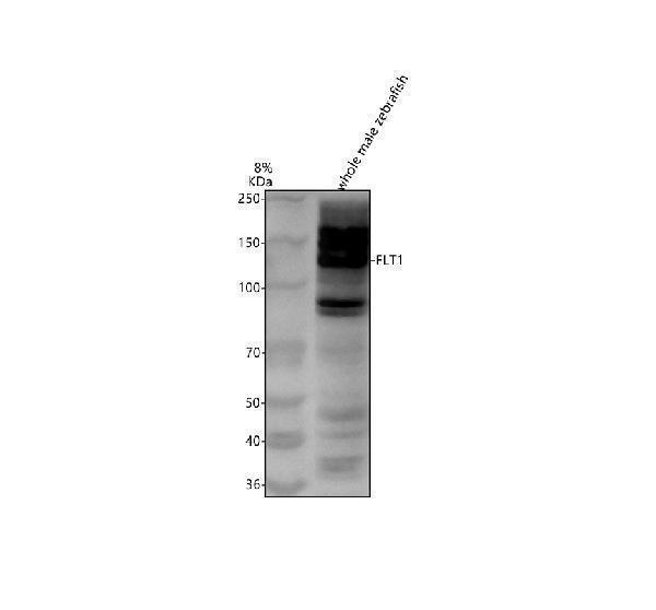 Western blot analysis of FLT1 using anti-FLT1 antibody (AZB3DKP1)