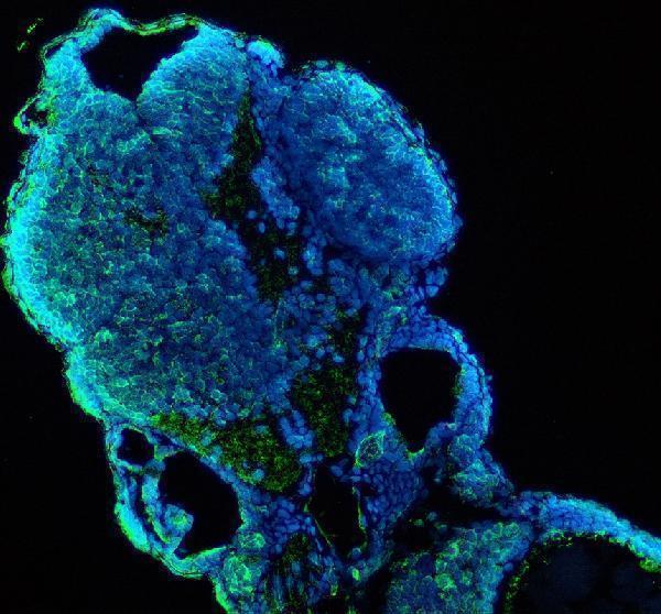 azb8jkd5 cyp1b1 primary antibodies if testing 1