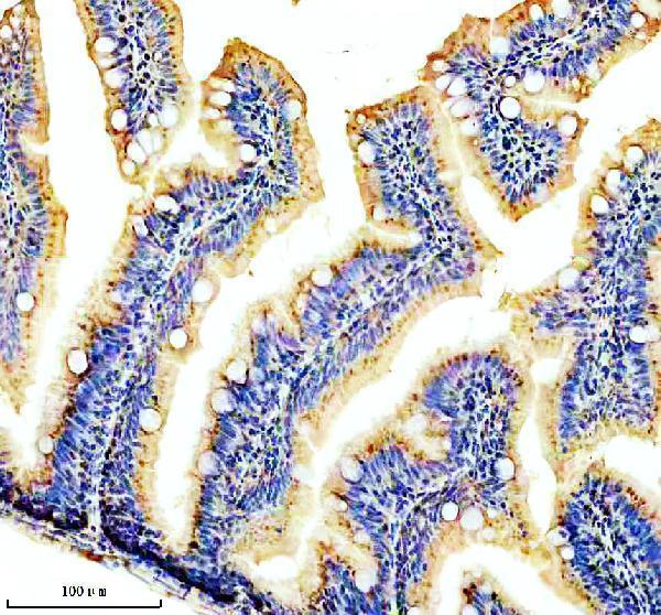 IHC analysis of CYP1B1 using anti-CYP1B1 antibody (AZB8JKD5)
