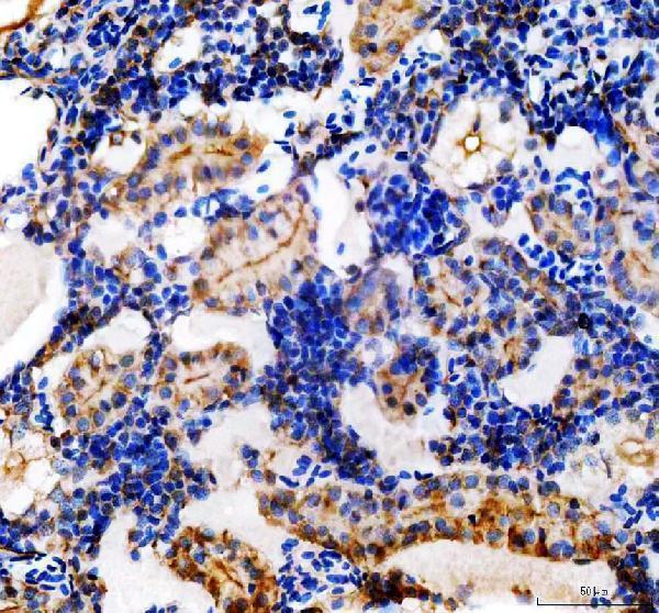 IHC analysis of CYP1B1 using anti-CYP1B1 antibody (AZB8JKD5)