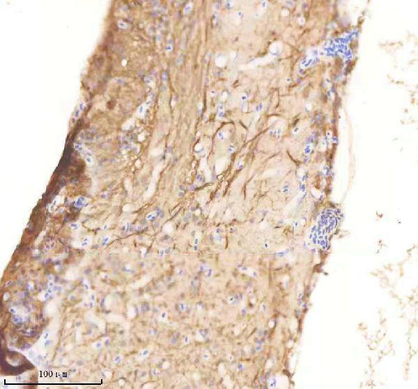 azb8jlc8 rab1aa ab primary antibodies ihc testing 1