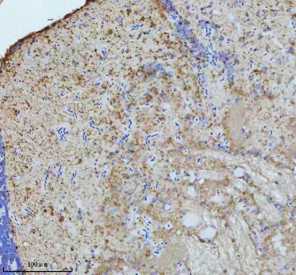  IHC analysis of GNAQ using anti-GNAQ antibody (AZB8JLJ7)