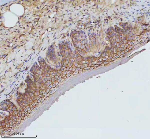  IHC analysis of GNAQ using anti-GNAQ antibody (AZB8JLJ7)
