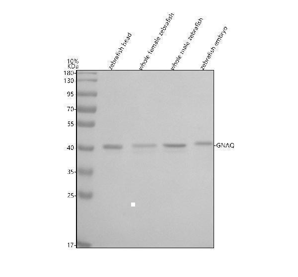  Western blot analysis of GNAQ using anti-GNAQ antibody (AZB8JLJ7)