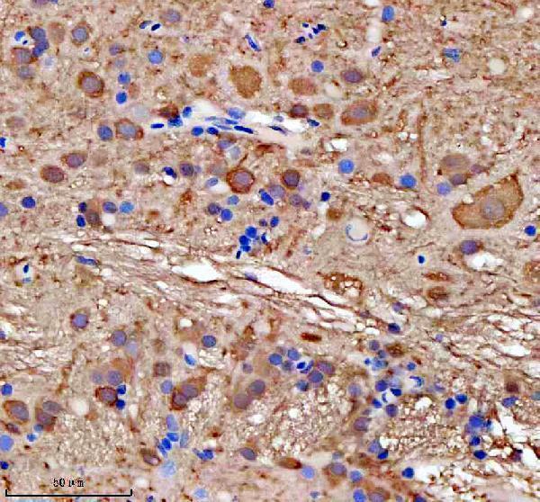 azb8jlw8 gmps primary antibodies ihc testing 1