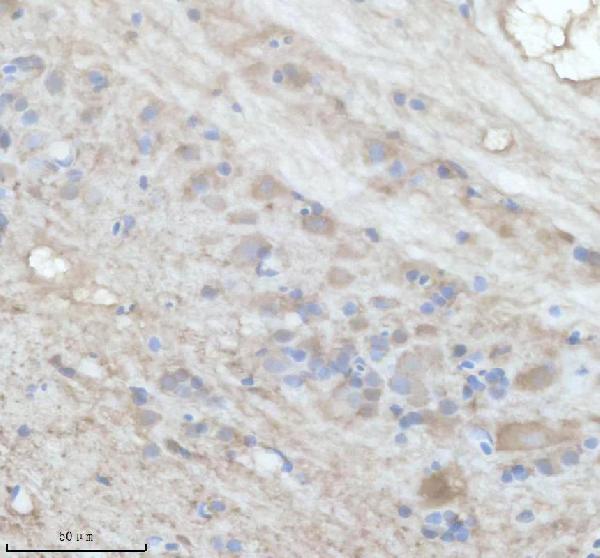 IHC analysis of IL4 using anti-IL4 antibody (AZD1YSM1)