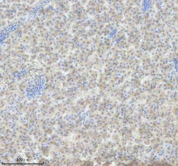 azd1ysm1 il4 primary antibodies ihc testing 3
