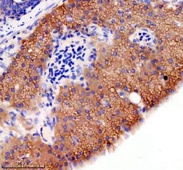 azd3kyk7 gphna b primary antibodies ihc testing 3