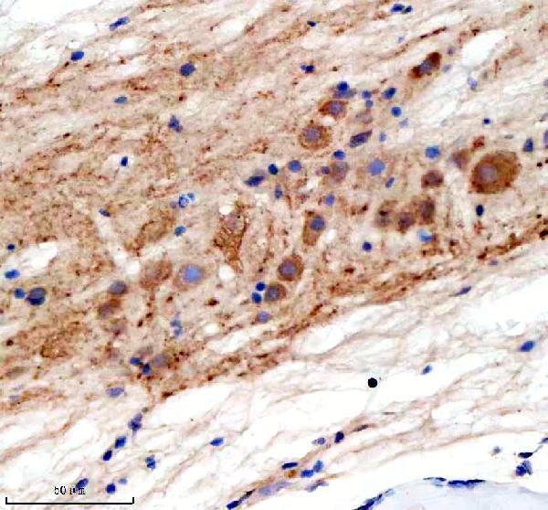 azd3kyk7 gphna b primary antibodies ihc testing 5