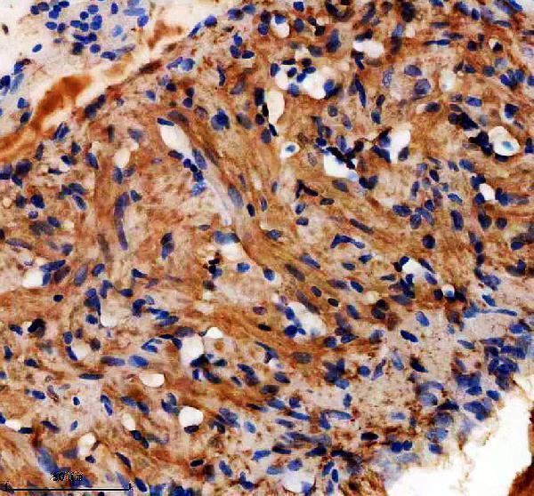 aze7f1a1 dapk2a primary antibodies ihc testing 1