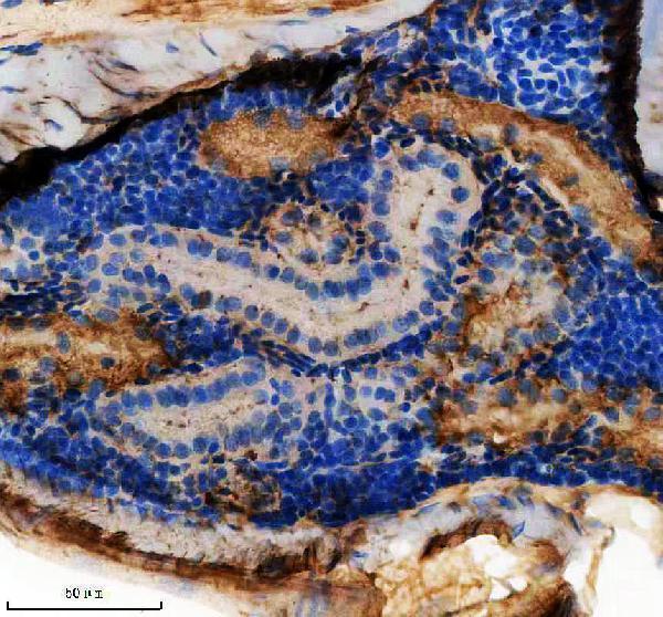 aze7f1a1 dapk2a primary antibodies ihc testing 2