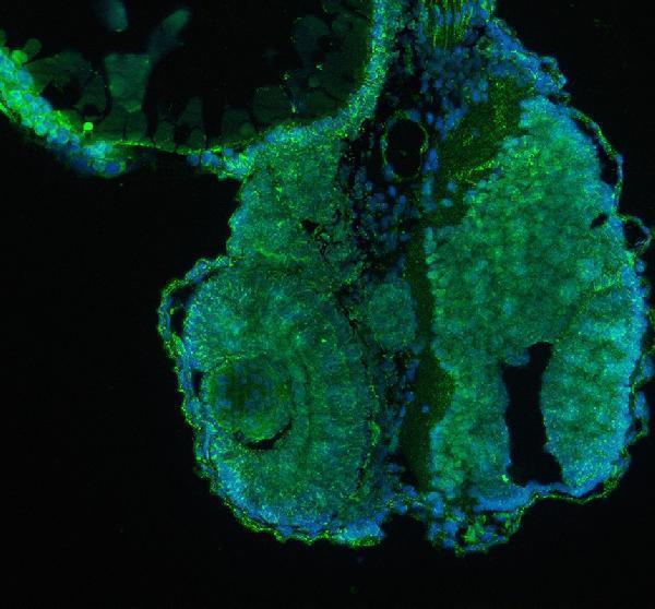 IF analysis of Kinase p110 Beta/PIK3CB using anti-Kinase p110 Beta/PIK3CB antibody (AZE7F251)