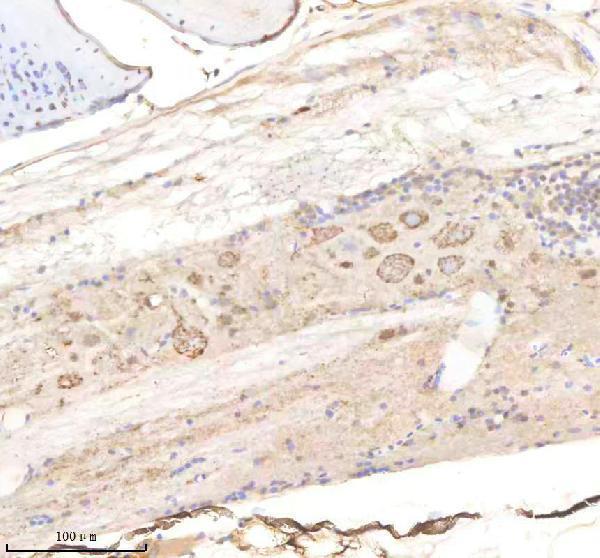 IHC analysis of Kinase p110 Beta/PIK3CB using anti-Kinase p110 Beta/PIK3CB antibody (AZE7F251)