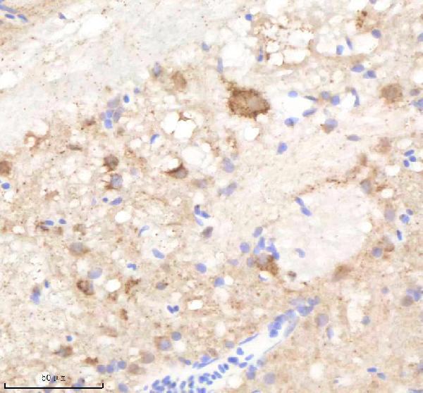 IHC analysis of Kinase p110 Beta/PIK3CB using anti-Kinase p110 Beta/PIK3CB antibody (AZE7F251)
