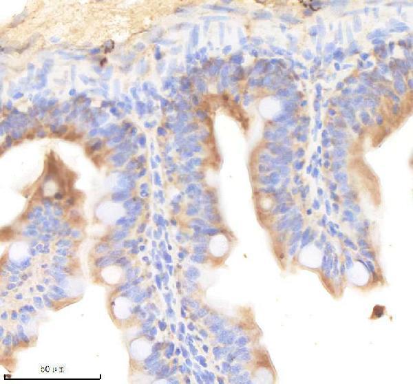 aze7f251 kinase p110 beta pik3cb primary antibodies ihc testing 3