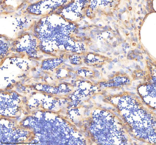 aze7f251 kinase p110 beta pik3cb primary antibodies ihc testing 4