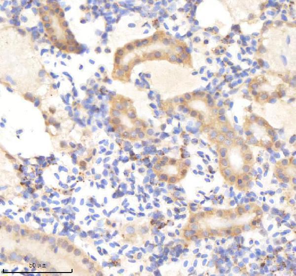aze7f251 kinase p110 beta pik3cb primary antibodies ihc testing 5