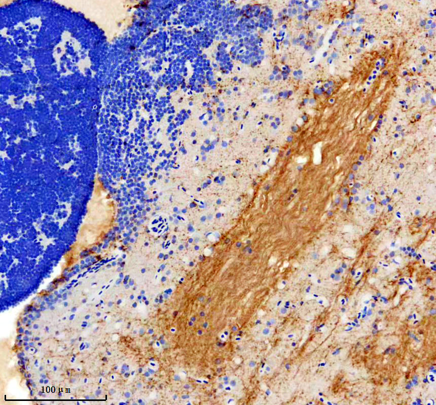 aze7f4g1 gfra3 primary antibodies ihc testing 1