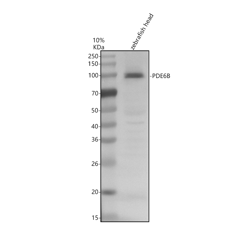 Western blot analysis of PDE6B using anti-PDE6B antibody (AZE7F5I9)