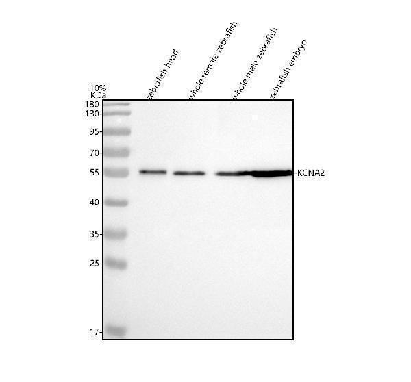  Western blot analysis of Kv1