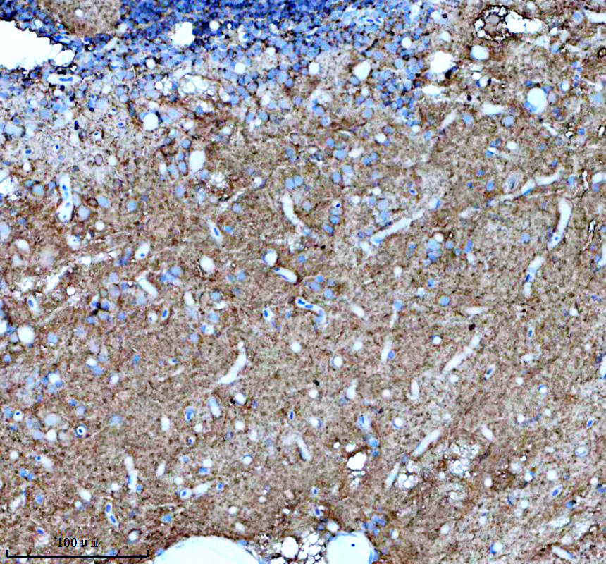 aze7f9u2 gsdmea primary antibodies ihc testing 1