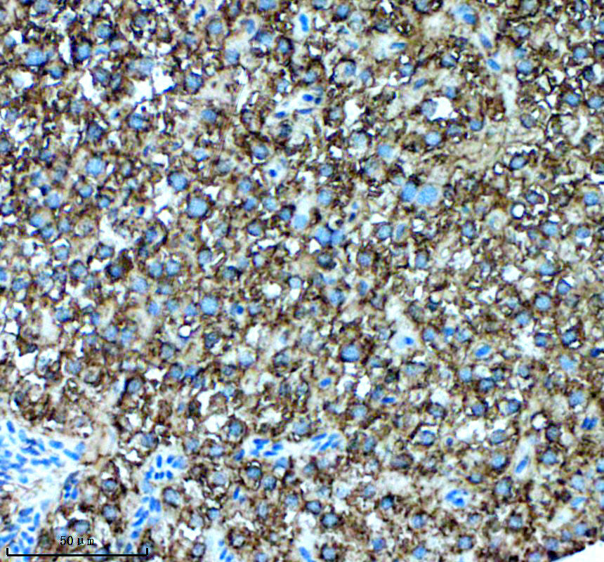 aze7f9u2 gsdmea primary antibodies ihc testing 2