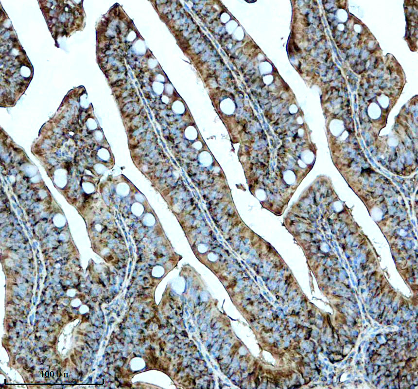 aze7f9u2 gsdmea primary antibodies ihc testing 3