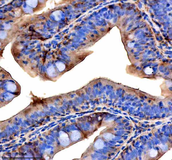 IHC analysis of VPS53 using anti-VPS53 antibody (AZE7FAG0)
