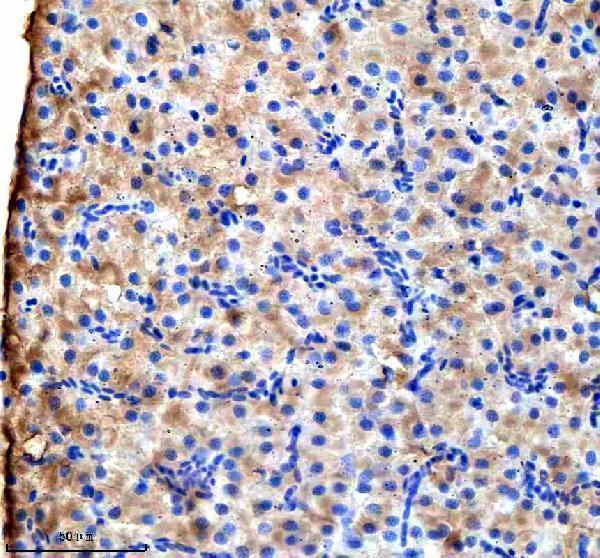 IHC analysis of VPS53 using anti-VPS53 antibody (AZE7FAG0)
