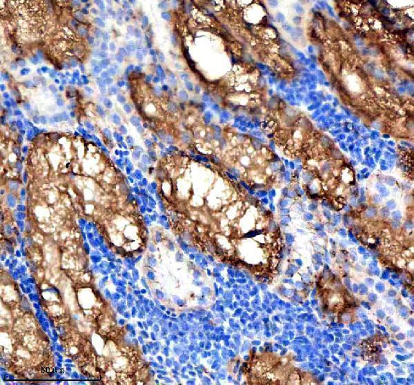 IHC analysis of VPS53 using anti-VPS53 antibody (AZE7FAG0)