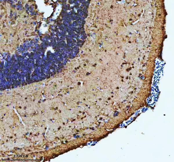  IHC analysis of ATP6V1A using anti-ATP6V1A antibody (AZE7FCD8)