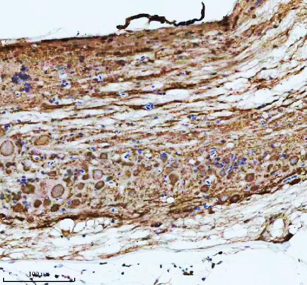  IHC analysis of ATP6V1A using anti-ATP6V1A antibody (AZE7FCD8)