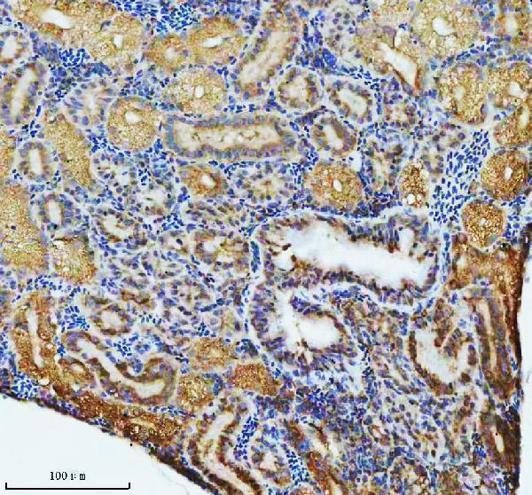 aze7fcd8 atp6v1a primary antibodies ihc testing 4