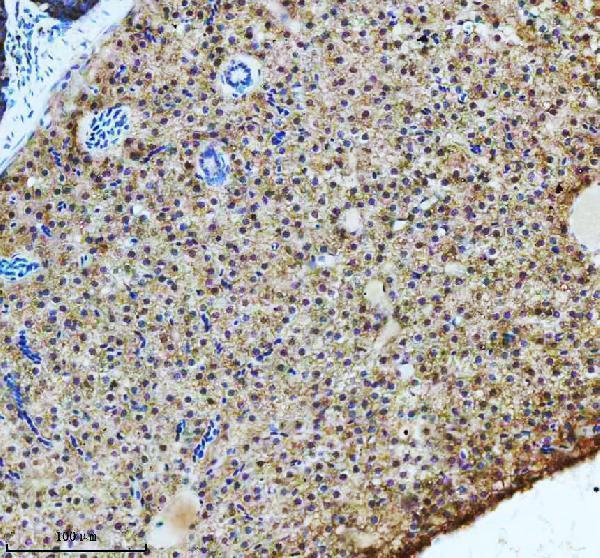 aze7fcd8 atp6v1a primary antibodies ihc testing 5