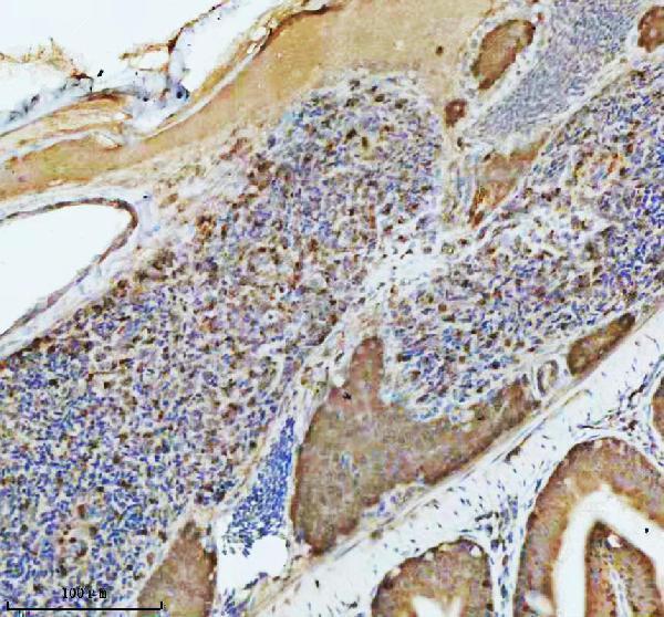 aze7fcd8 atp6v1a primary antibodies ihc testing 6
