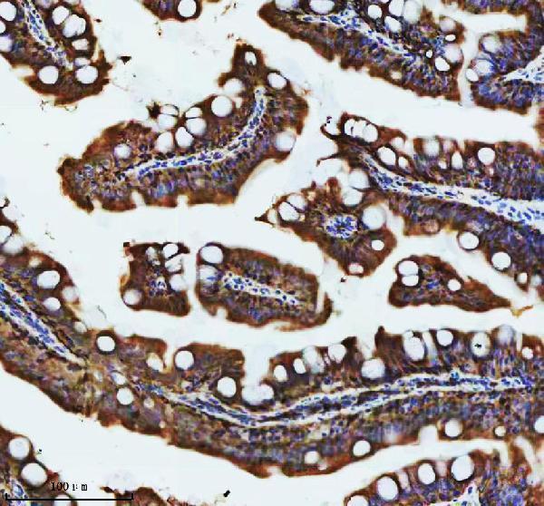 aze7fcd8 atp6v1a primary antibodies ihc testing 7