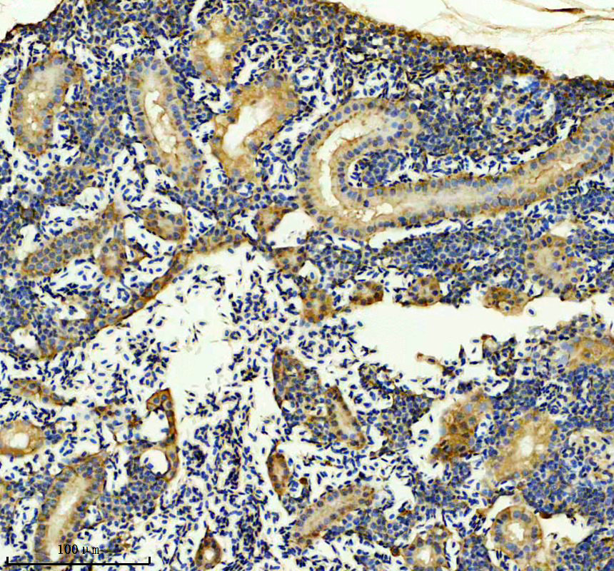 azf1q5g5 gla primary antibodies ihc testing 1