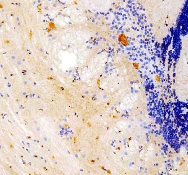 azf1q6q6 myo6a primary antibodies ihc testing 1