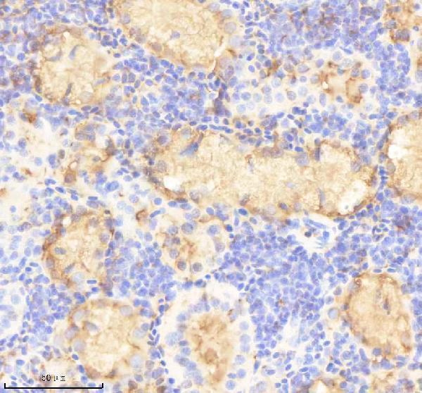 azf1qae1 prox1a primary antibodies ihc testing 1