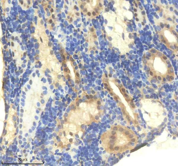 azf1qcg4 nfkbiaa primary antibodies ihc testing 1