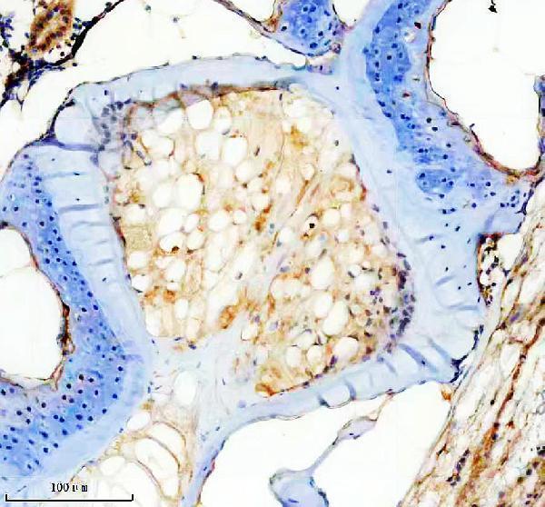 azf1qcx8 mmp13a primary antibodies ihc testing 1