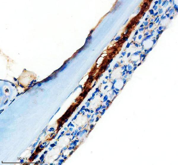 azf1qcx8 mmp13a primary antibodies ihc testing 2