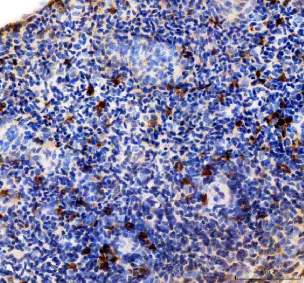 azf1qcx8 mmp13a primary antibodies ihc testing 3