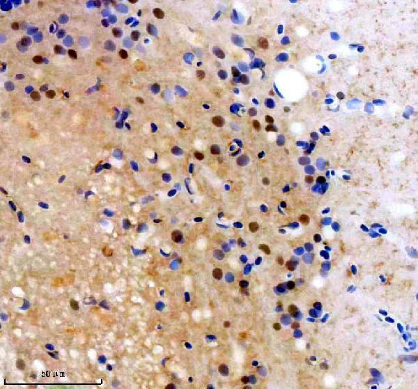 azf1qdf8 foxj1a primary antibodies ihc testing 1