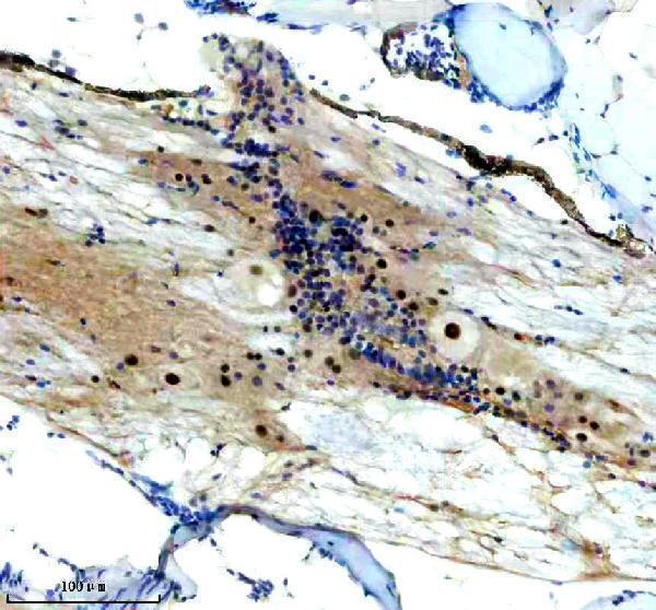 azf1qdf8 foxj1a primary antibodies ihc testing 2