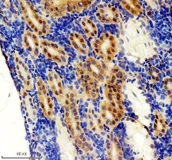 azf1qdf8 foxj1a primary antibodies ihc testing 3