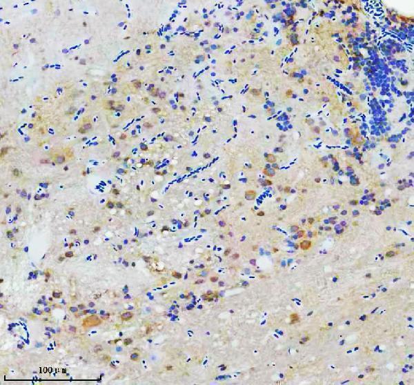  IHC analysis of Flotillin 1/FLOT1 using anti-Flotillin 1/FLOT1 antibody (AZF1QEW4)