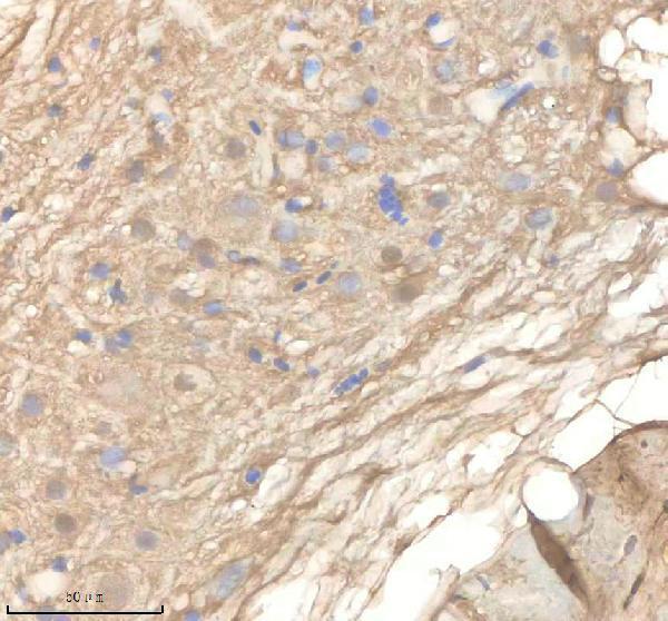 IHC analysis of PPM1G using anti-PPM1G antibody (AZF1QJE5)