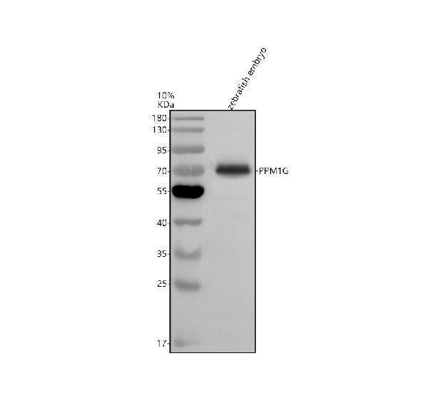 Western blot analysis of PPM1G using anti-PPM1G antibody (AZF1QJE5)